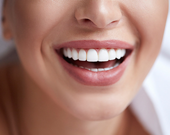 Cosmetic Dentistry