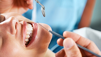 What are Dental Sealants
