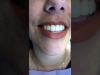 smile-gallery-video2