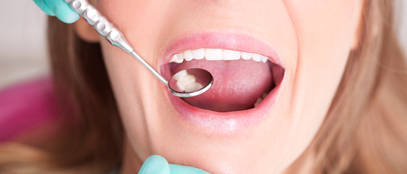 How to Address and Treat Dental Cavities