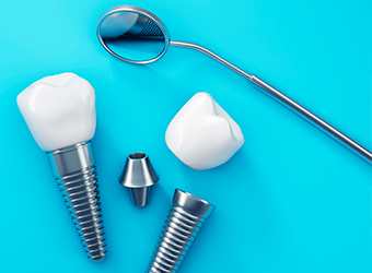 A Complete Guide to Dental Implants