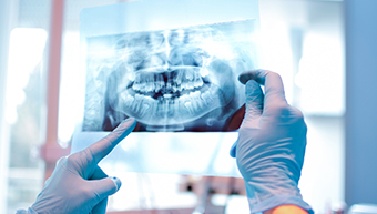 How Can an Emergency Dentist Help You?
