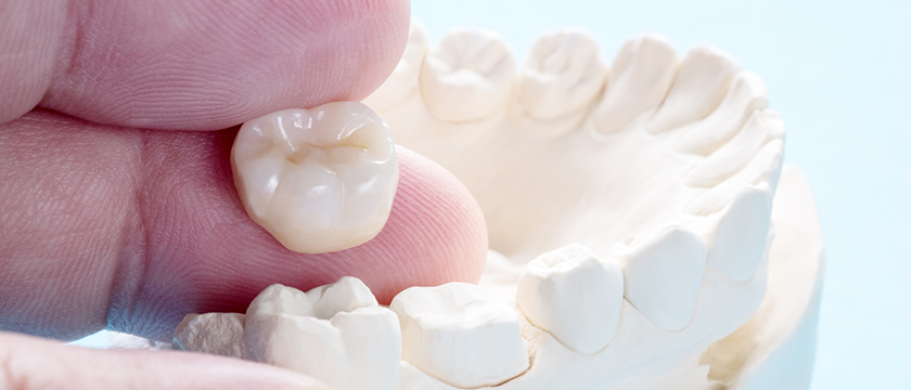 How a Dental Crown Can Help Improve Your Smile
