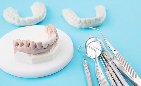 Get A Great Smile with Beautiful Dental Crowns 