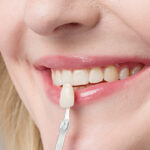How Veneers Can Improve Your Oral Health