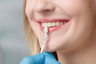 Everything You Need to Know About Dental Veneers