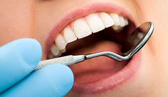 Tooth Decay Treatment from Best Dentist Mississauga