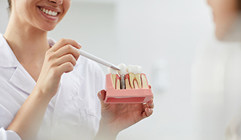 Long-Lasting Dental Implants in Mississauga