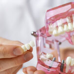 Your Complete Guide to Dental Bridges