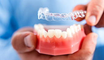 Best Invisalign Dentist in Mississauga