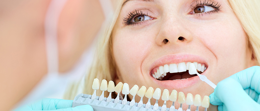 Why You Should Whiten Your Teeth at the Dentist