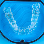 How Invisalign Treatment Improves Your Health