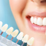 Top 8 Cosmetic Dental Treatments You Should Know