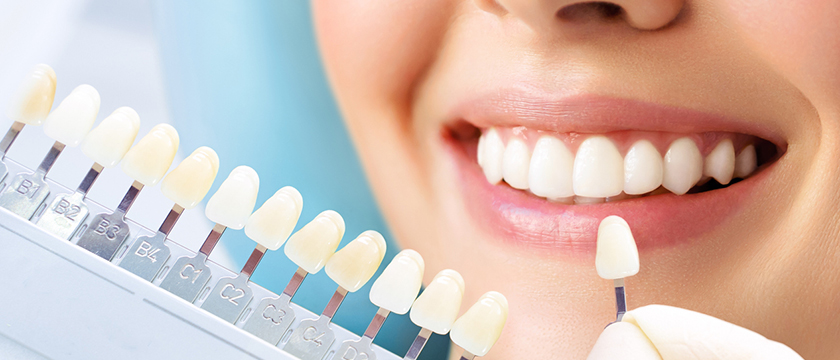 8 Cosmetic Dental Treatments You Should Know