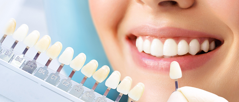 Top 8 Cosmetic Dental Treatments You Should Know