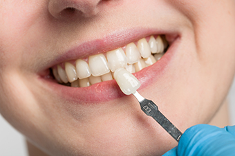 Porcelain vs. Composite Veneers