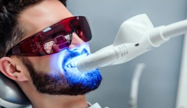 All You Need to Know About Zoom Teeth Whitening