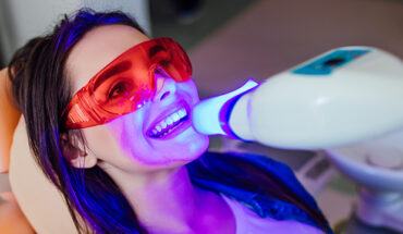 In-Home vs. Professional Teeth Whitening: Know the Pros and Cons