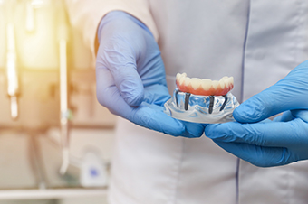 High-Quality Full mouth Dental Implants in Mississauga
