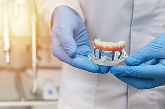 High-Quality Full mouth Dental Implants in Mississauga