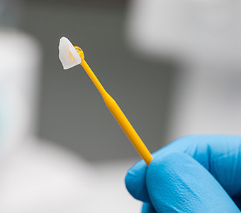 what-are-veneers-understanding-the-benefits-costs-and-alternatives