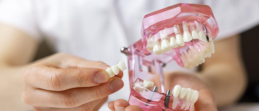 A dentist at Trillium Smile Dentistry showing a dental bridge model to explain how it helps replace missing teeth.