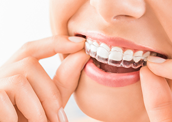 Is Invisalign Covered by Insurance in Canada?